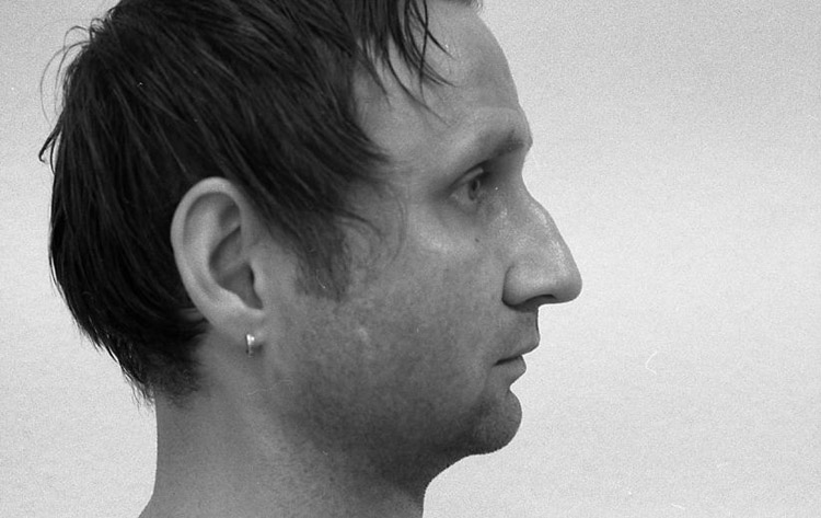 Höcker-Großnase, vor der Operation. 