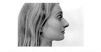 Foto-Galerie Ansichten des Gesichts dienen als Arbeitsgrundlage fr die Nasenchirurgie, Vorher Foto